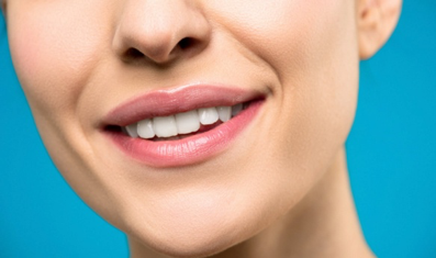 Ideal Smiles Dental Teeth Whitening