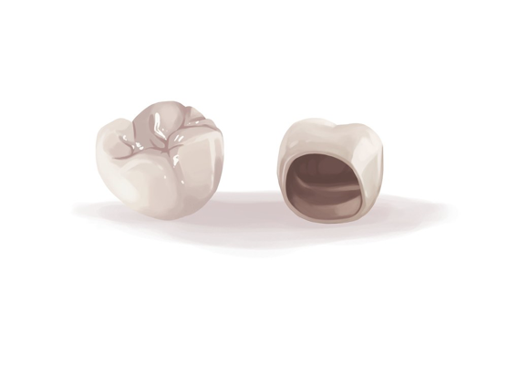 Dental Crowns