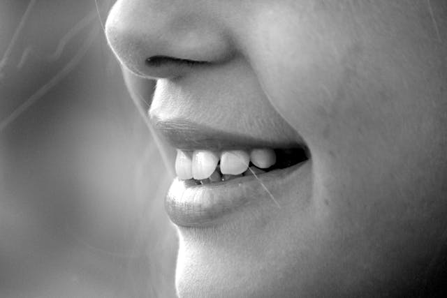 Best Routine Dental Checkups for Oral Health Staten Island NY