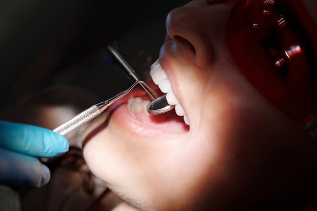 Top Benefits of Teeth Whitening to Brighten Your Smile
